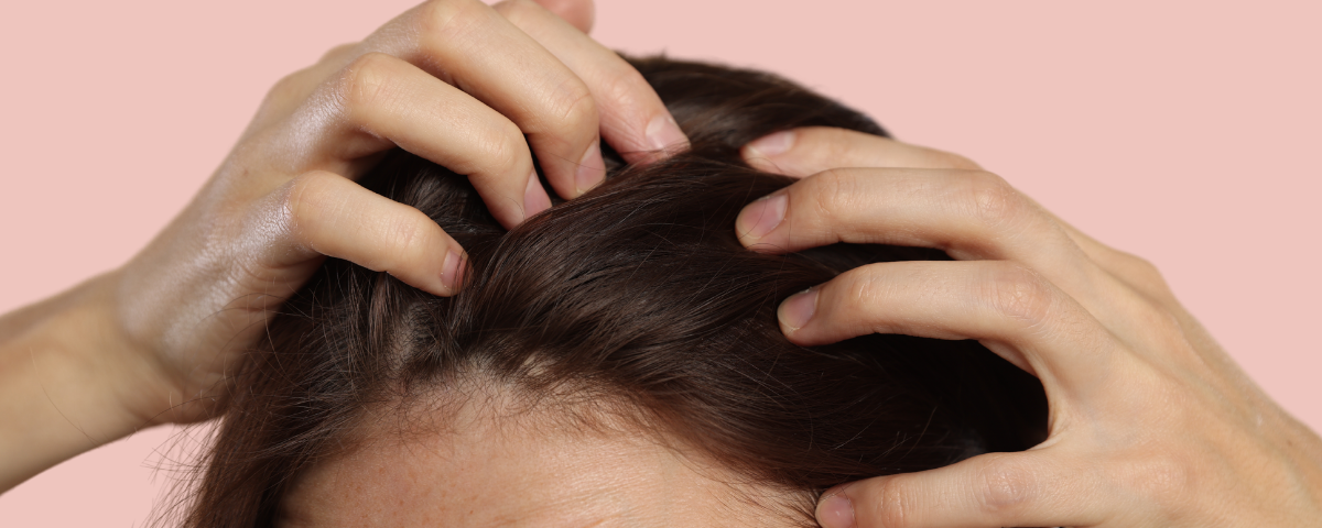 Gereizte Kopfhaut und Schuppen